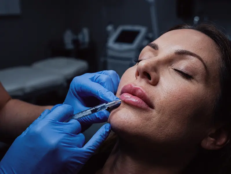 Lip Filler — Anti-Aging (1 Syringe)